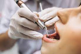 10 Scariest Things About Dental